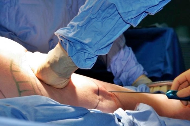 Cosmetic Surgery