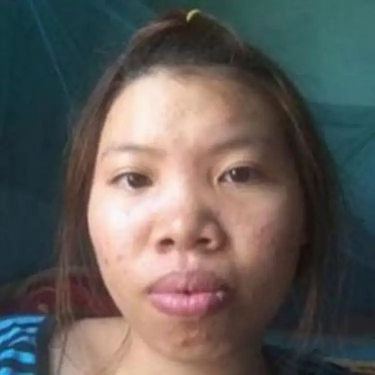 Ugly filipino girl