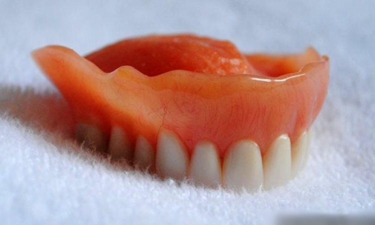 Dentures Found Stuck In Mans Throat 8 Days After Surgery