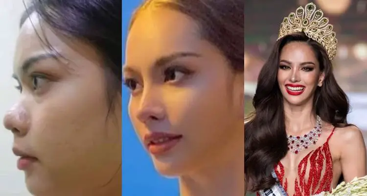 Miss Universe Thailand 2022 Anna Sueangam-iam Before & After Photos