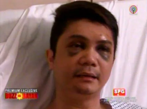 Vhong Navarro intervie