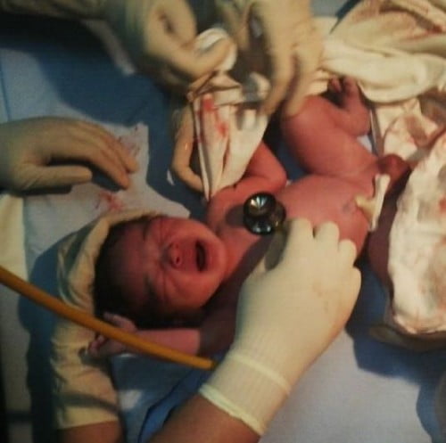 Bernard Palanca Baby