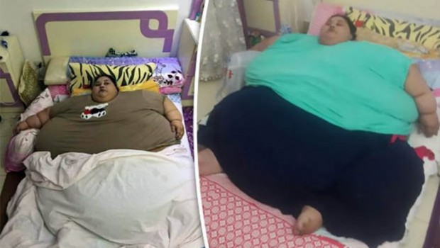 World's Heaviest Woman To Undergo Weight Reduction Surgery