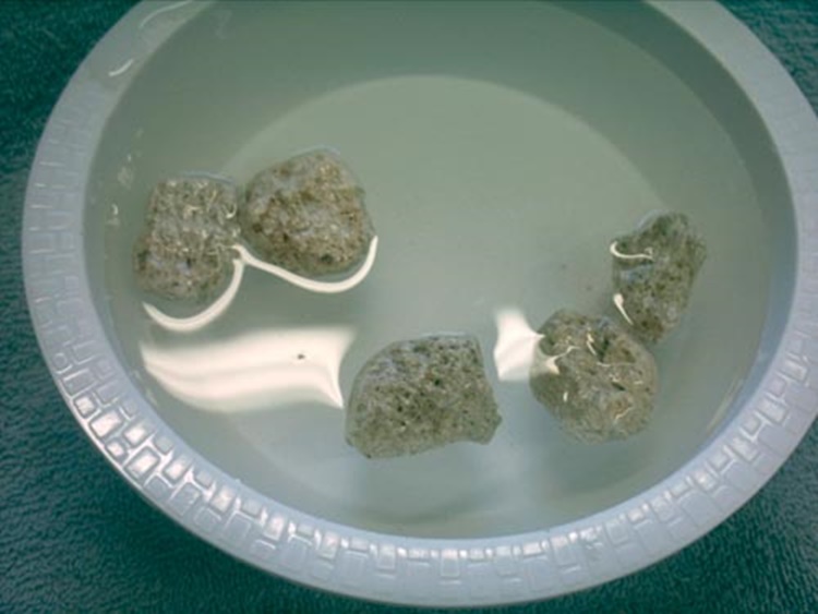 Natural Home Remedies