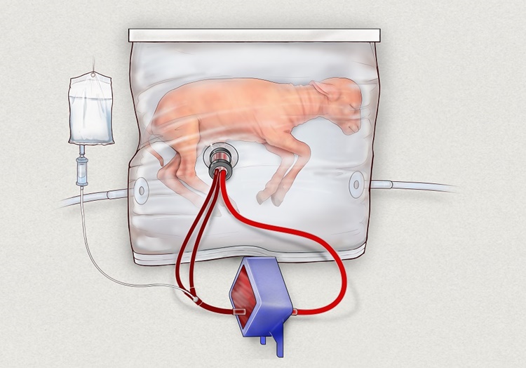 Artificial Womb