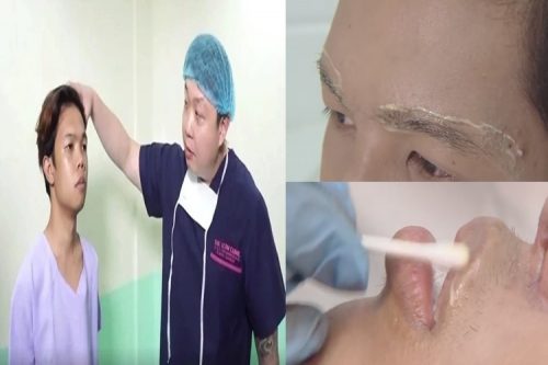 Marlou Arizala’s New Look