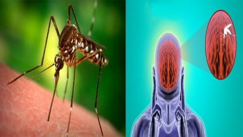 Japanese Encephalitis