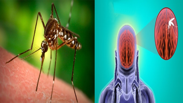 Overview About Japanese Encephalitis, Virus Spread By Mosquitoes