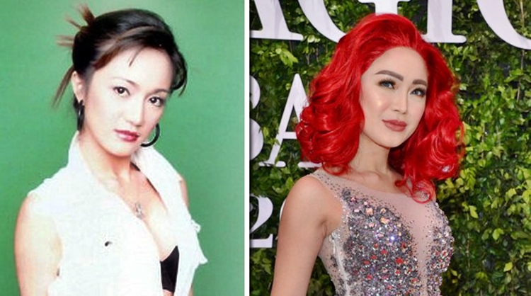 cosmetic surgery