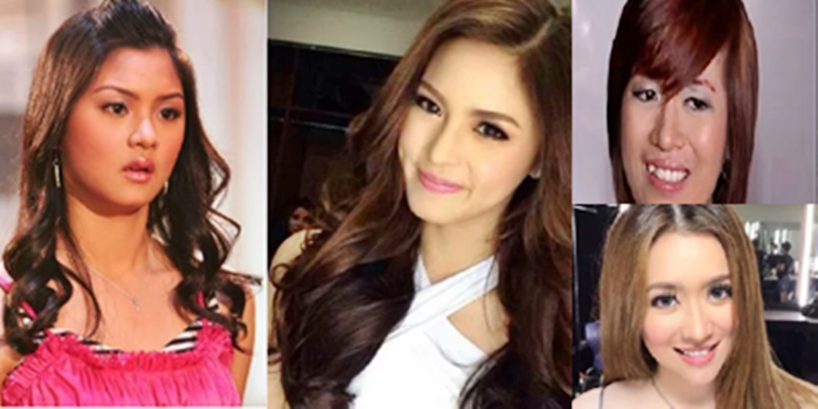 Filipino Celebrities' Shocking Transformation After Fame