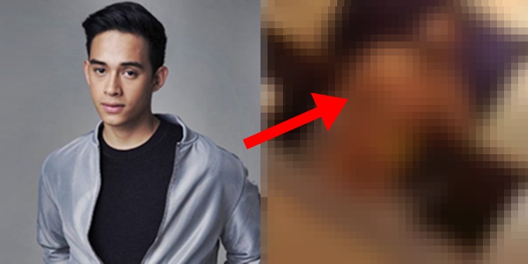 Diego Loyzaga Finally Speaks Up On Controversial Naked Photo