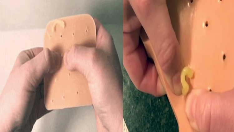 pimple popper fidget