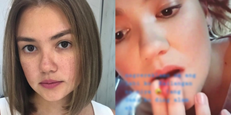 Angelica Panganiban Expresses Pain On Lips, Actress Asks What It Needs