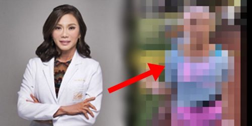 Vicki Belo