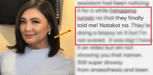 sharon cuneta surgery