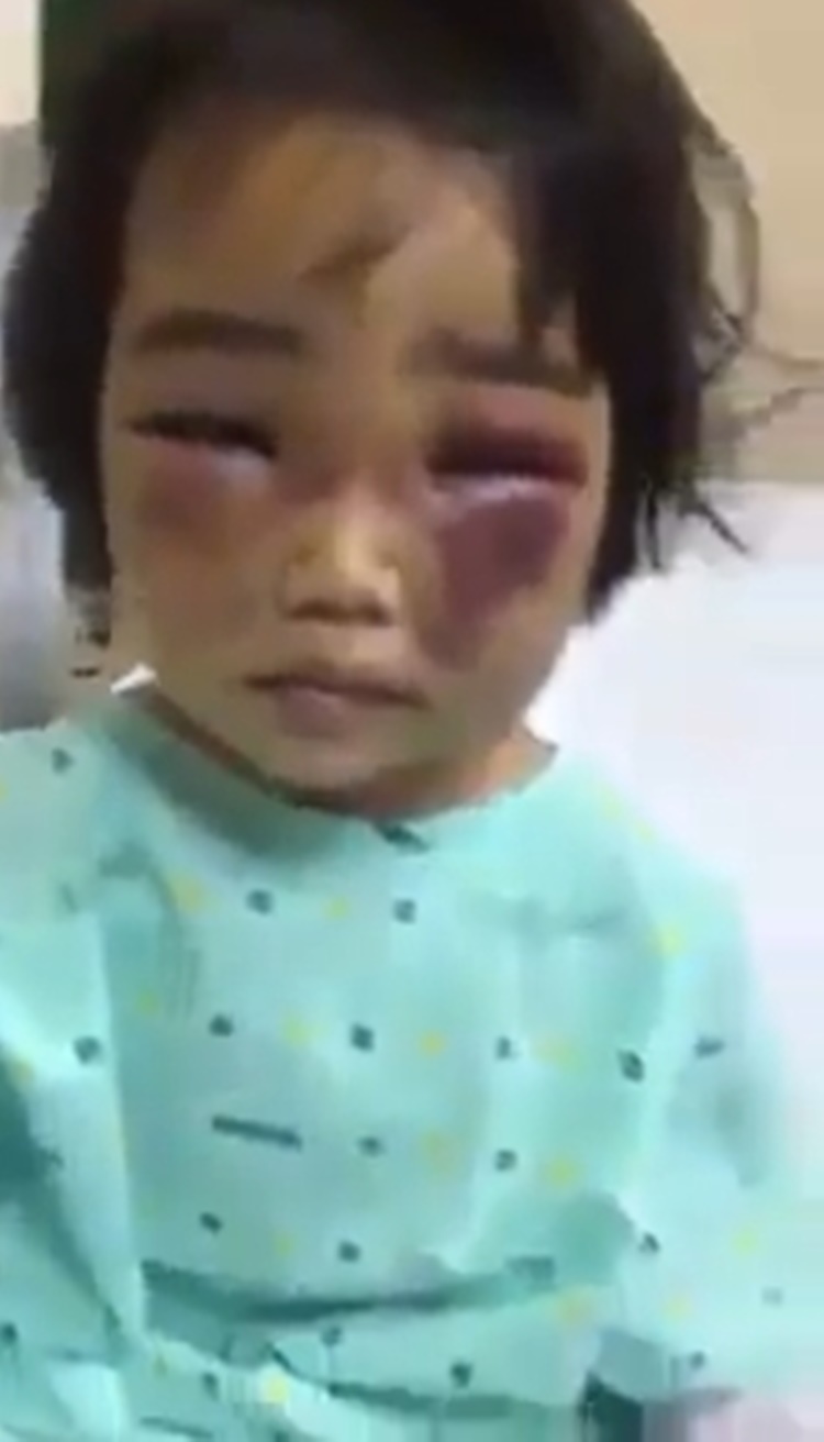 Heartbreaking Video Of Young Victim Of Child Abuse Goes ...