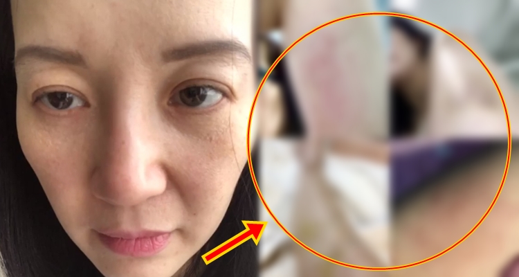 Kris Aquino Shows Disturbing Effects