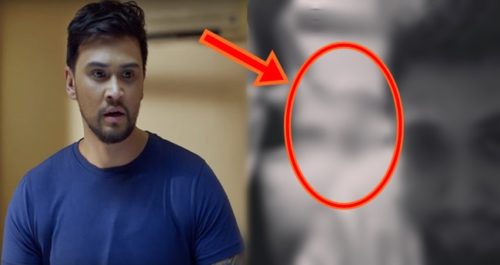 Billy Crawford foot injury