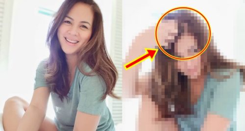 Lara Quigaman Bald Spot