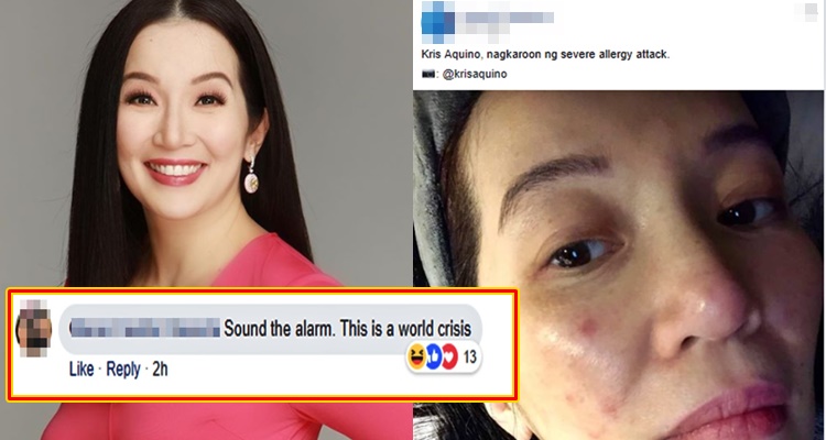 News About Kris Aquino S Severe Allergy Attack Elicits Funny Comments