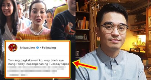 Kris Aquino 2nd Loss