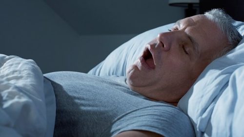 Causes of Snoring
