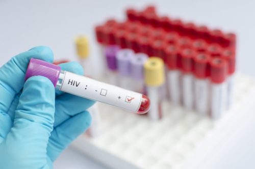 hiv treatment
