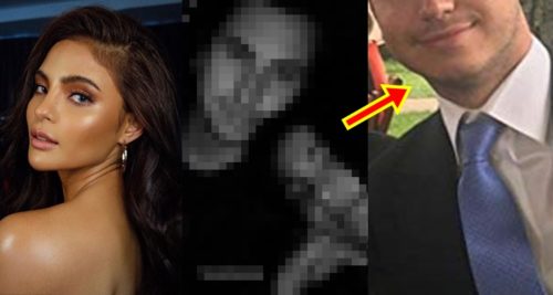 Lovi Poe Love Interest