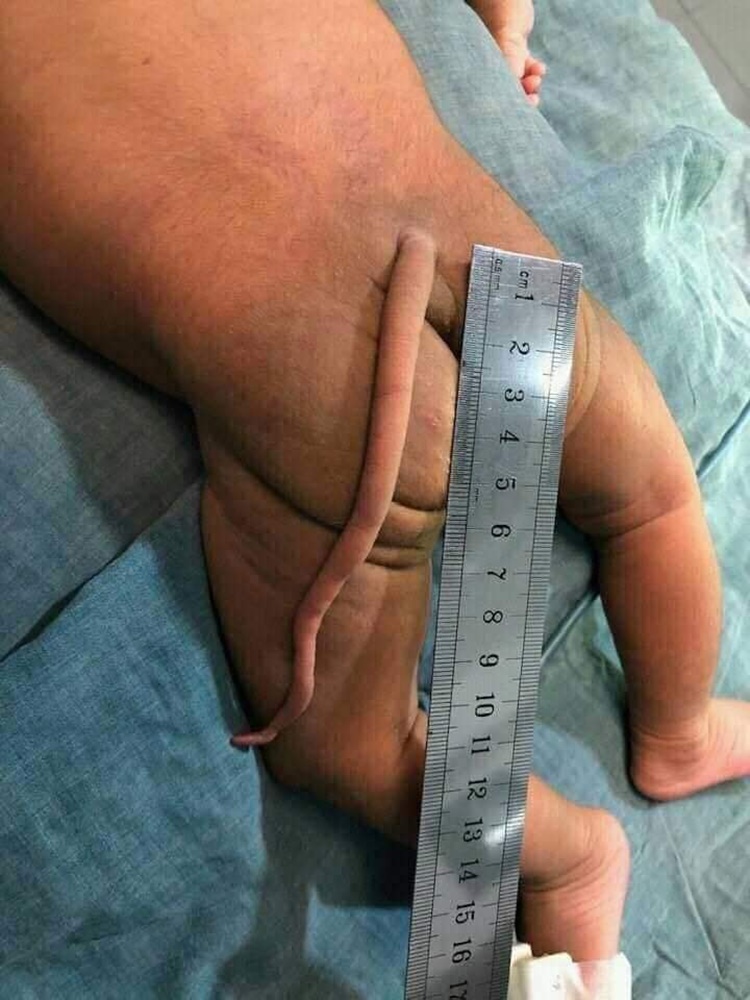 Human Tail