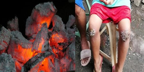 Mother makes daughter kneel on embers 1
