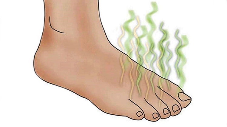 smelly-feet-causes-prevention-how-to-get-rid-of-stinky-feet