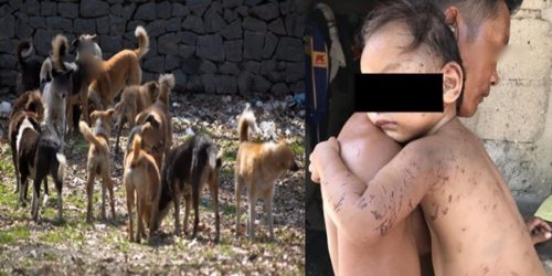 Toddler attacked by dogs 1