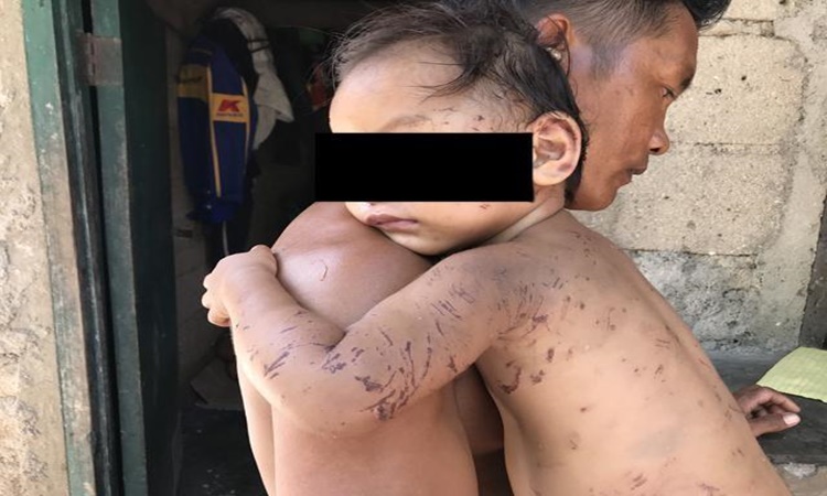 Toddler-attacked-by-dogs