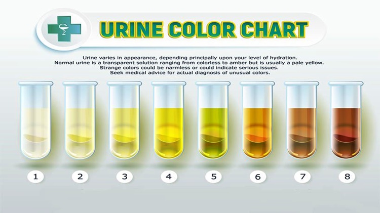 Health Tips: What Does The Color Of Your Urine Tells About Your Health?