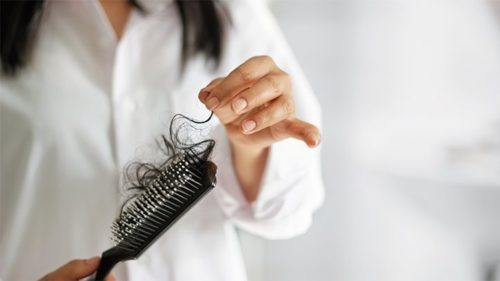 Hair Loss
