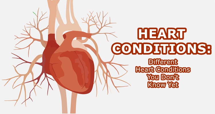 heart-conditions-different-heart-conditions-you-don-t-know-yet