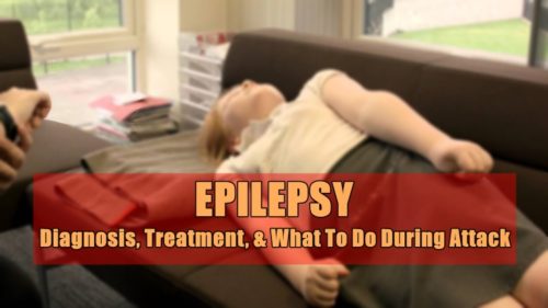 epilepsy diagnosis treatment what to do