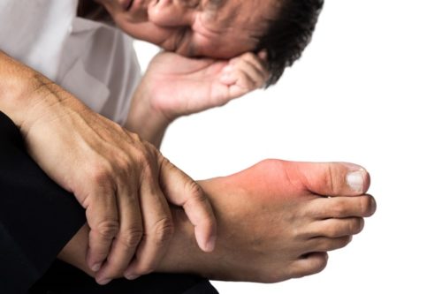 GOUT