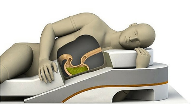 lying on left side helps reduce heart burn