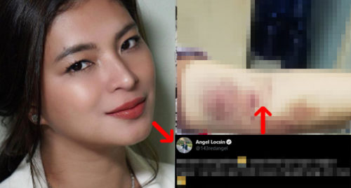 ANGEL LOCSIN