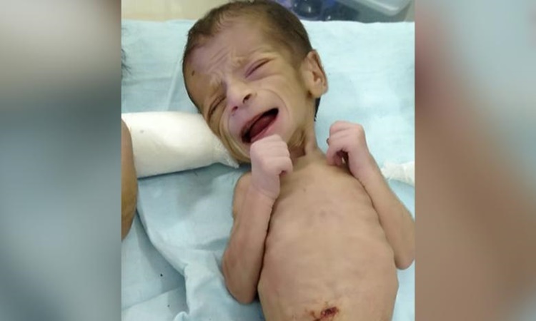 Baby-India-infanticide