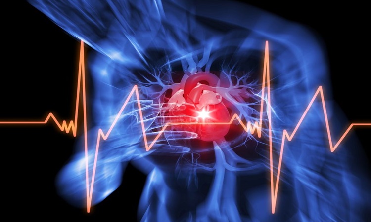 cardiac-arrest