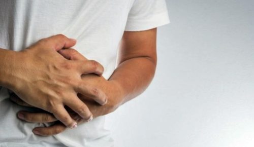 intestinal obstruction