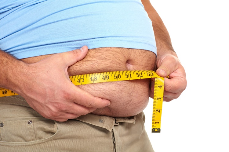 OBESITY