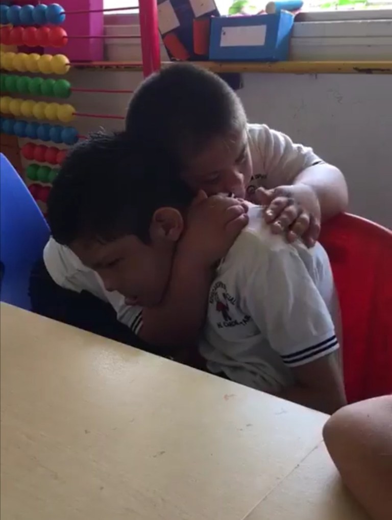 Boy with Down Syndrome