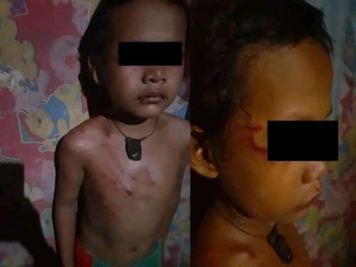 Heartbreaking Photos