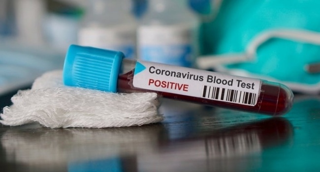 US Monitors 1000 People For Suspected Coronavirus