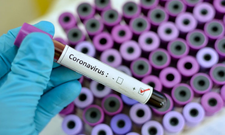 Coronavirus-testing-1