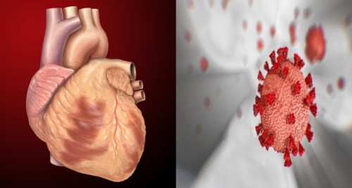 Coronavirus Disease