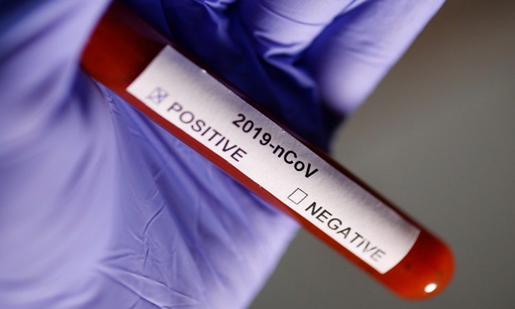 Coronavirus-PH-1-1
